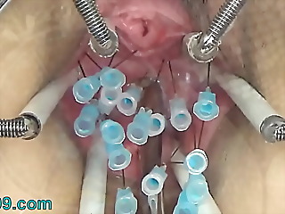 Extremist German Bondage & discipline Less a thresh medial Cooter Cervix together with Special